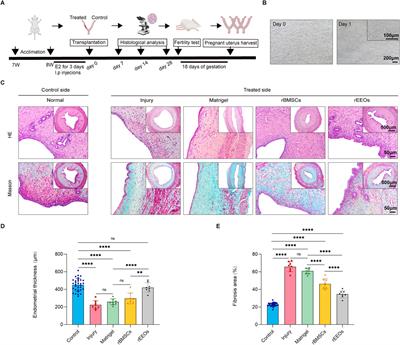 Engraftment of self-renewing endometrial epithelial organoids promotes endometrial regeneration by differentiating into functional glands in rats